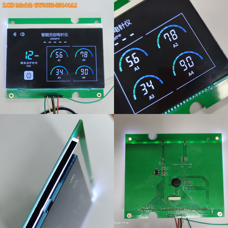 6 inch COB+PCB VA Display Segment LCD Module For Intelligent Medical Equipment