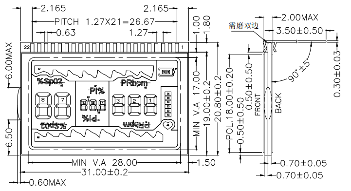 LCD.png