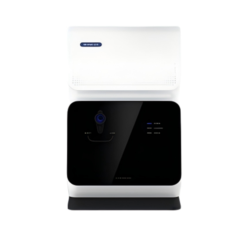 Anion Exchange Chromatography